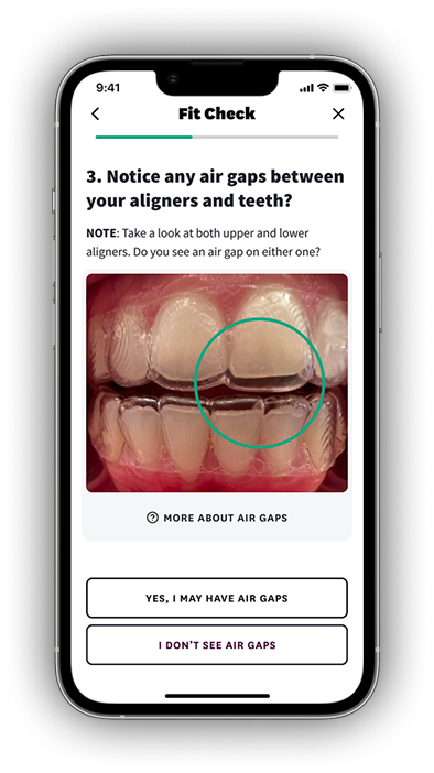 Aligner Fit Fotos experience